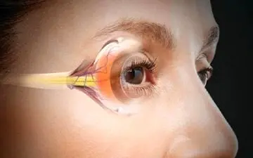 راهی برای درمان نابینایی در پیری