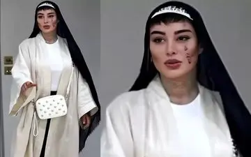 ماجرای سکته مغزی سحر قریشی چه بود؟ چه کسانی از او حلالیت طلبیدند؟ + ویدئو