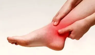 شناخت زودهنگام علائم، کلید درمان مؤثر آرتروز مچ پا