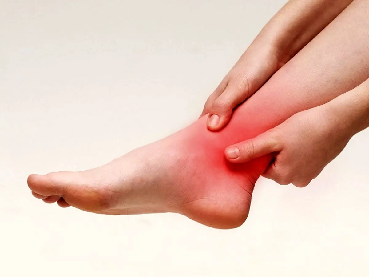 شناخت زودهنگام علائم، کلید درمان مؤثر آرتروز مچ پا