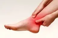 شناخت زودهنگام علائم، کلید درمان مؤثر آرتروز مچ پا