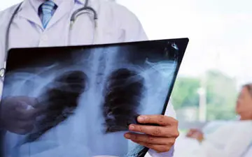 درمان گیاهی التهاب در ریه واختلال در تنفس 