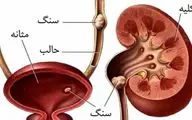 قوی ترین داروی گیاهی برای درمان سنگ کلیه!