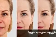 جوانسازی پوست صورت با تغذیه + روش سریع خانگی