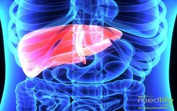  داروی کبد چرب یک قدم تا موفقیت