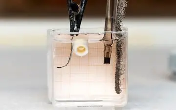 درمان شکستگی استخوان با یک روش شگفت انگیز 