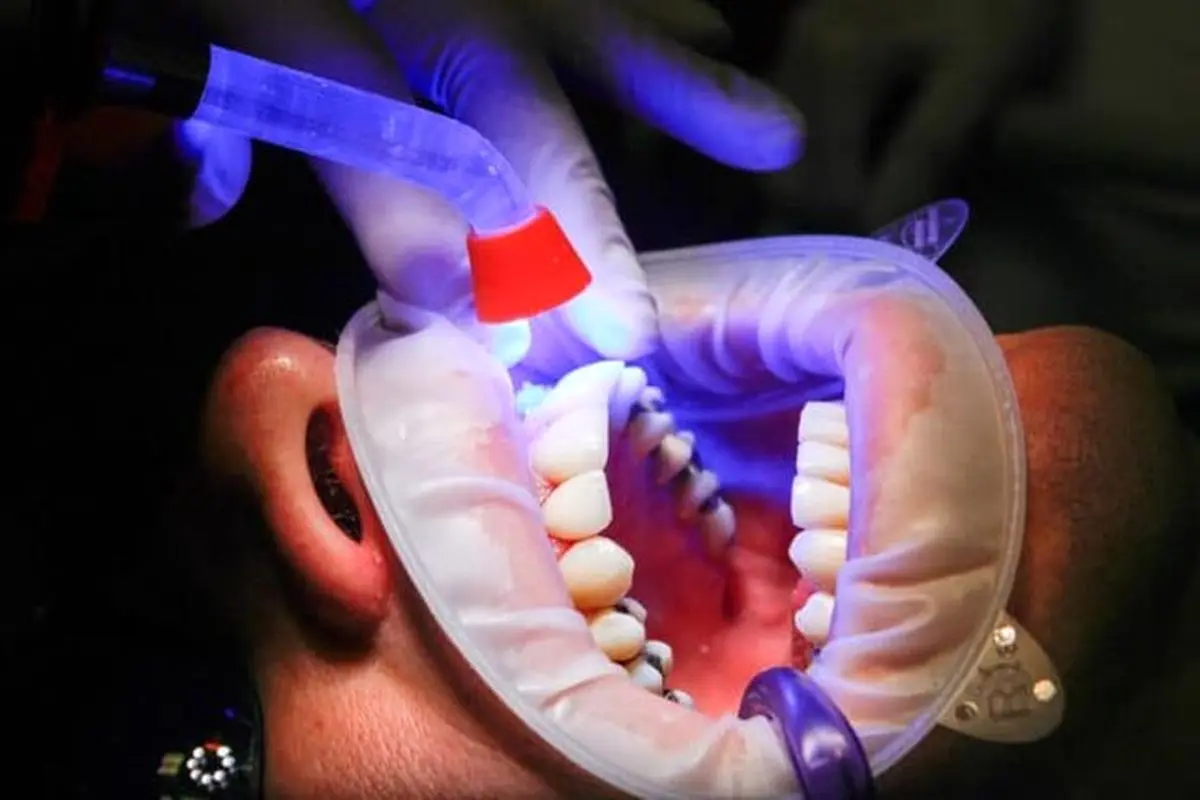 راه های مقابله با بیماری‌های شایع دندان