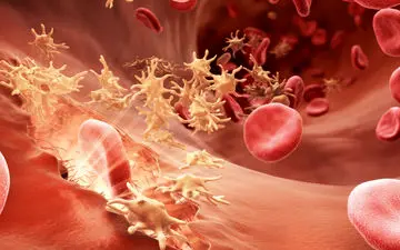 هموفیلی بیماری وابسته به جنسیت