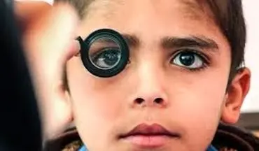 زمان طلایی برای تشخیص تنبلی چشم کودکان