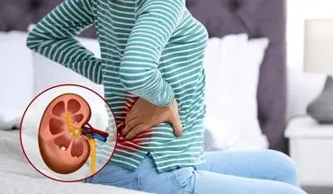 نشانه‌های اولیه بیماری‌های کلیوی که نباید نادیده بگیرید