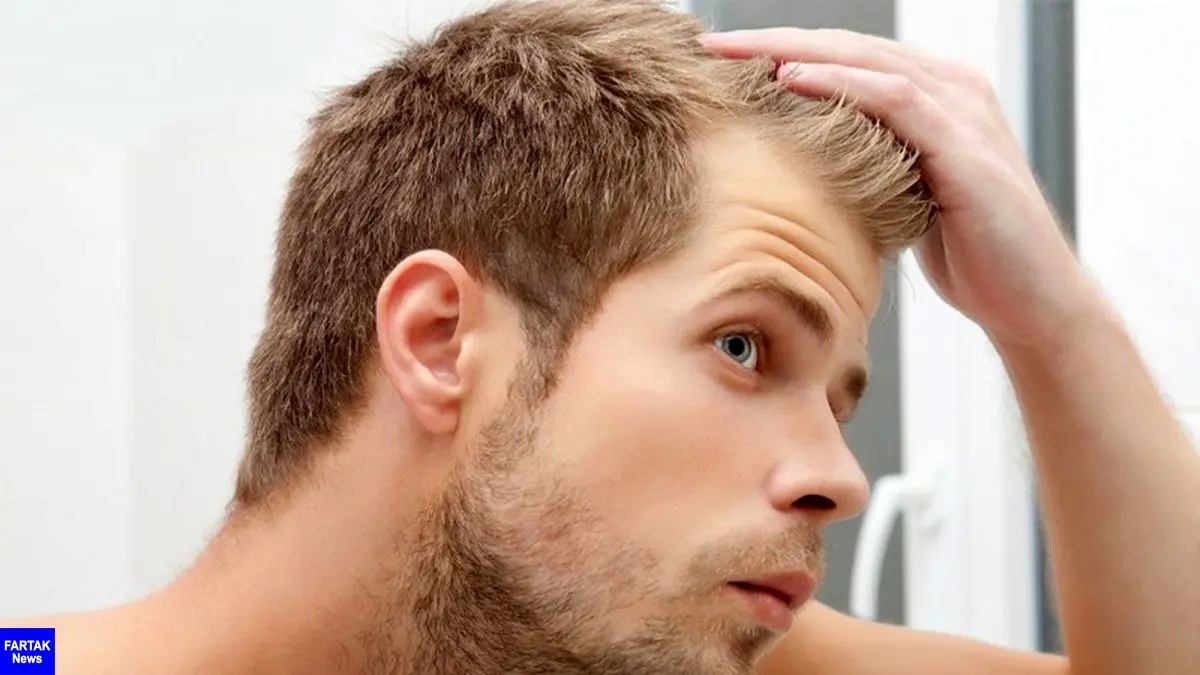 نکات مهم در رابطه با ریزش مو و روش های درمان