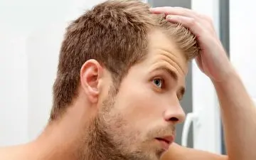 نکات مهم در رابطه با ریزش مو و روش های درمان