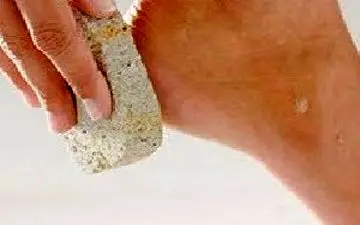 ترک پا؛ علل و درمان‌های خانگی