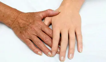 پیر شدن دست‌ها را به تعویق بیندازید: راز‌های طلایی مراقبت از پوست دست

