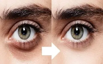 رفع سیاهی و گودی زیر چشم با ترک این 7 عادت اشتباه