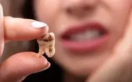 نقش دندان عقل از گذشته تا به امروز؛ جویدن تا نجات دادن جان انسان