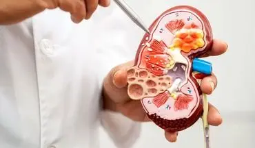برای سلامت کلیه خود حتما این موارد را رعایت کنید!