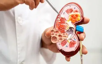 برای سلامت کلیه خود حتما این موارد را رعایت کنید!