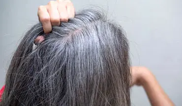 انواع راه‌های درمان موی سفید