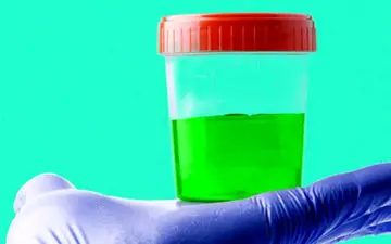 علت تغییر رنگ ادرار به سبز یا آبی