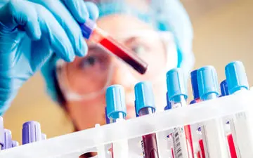  آزمایش هایی که خانم ها باید انجام دهند