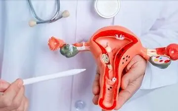 آیا اندومتریوز درمان نشده خطرناک است؟