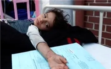 بیماری وبا تلفات زیادی در یمن داد