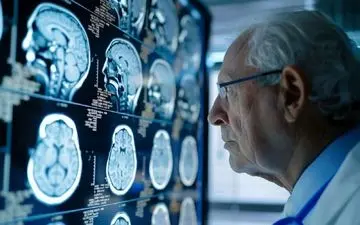 کاهش خطر زوال عقل با واکسن‌ها، آنتی‌بیوتیک‌ها و داروهای ضدالتهابی
