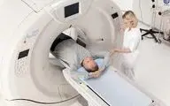 هشدار ابتلا به سرطان درباره سی‌تی‌اسکن |  بی رویه انجام ندهید 
