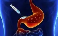 در مورد اثرات  بوتاکس معده چه می دانید؟