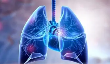 شایع‌ترین علائم سرطان ریه را بشناسید