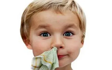  علت خونریزی بینی در تابستان