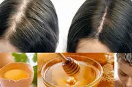 درمان ریزش مو با ماسک تخم مرغ و عسل (معجزه‌ای برای موهای ضعیف)