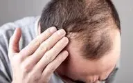 موهای از دست‌رفته را برگردان!  رشد مجدد مو با کمک یک قند خاص!
