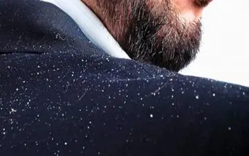 
مراقبت از موها در فصل سرما