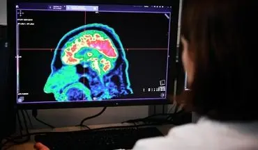 تشخیص تومور مغزی با هوش مصنوعی| هوش مصنوعی به سرعت تشخیص می‌دهد