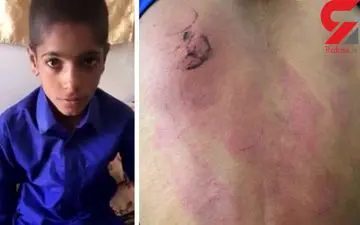 تنبیه وحشیانه دانش آموز پسر با خط کش توسط معلم +فیلم