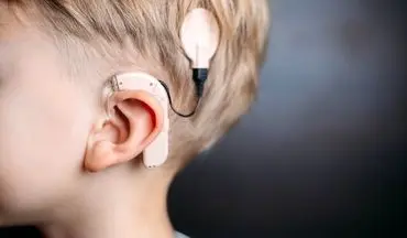 
کدام بیماران به کاشت حلزون شنوایی نیاز دارند؟