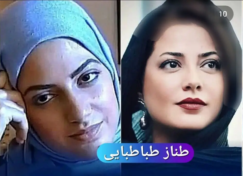 عکس بازیگران زن ایرانی قبل و بعد از عمل زیبایی