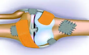 این افراد بیشتر در معرض پوکی استخوان قرار دارند!