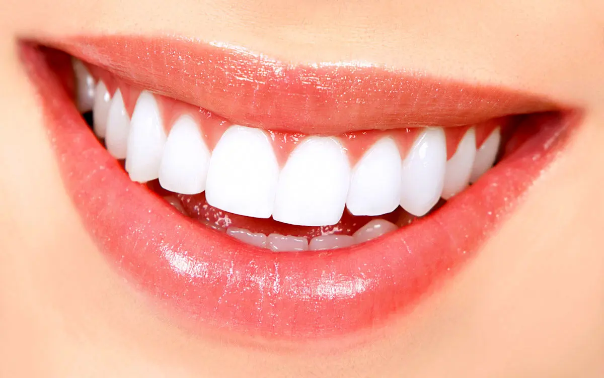  از این هفت ماده غذایی مضر دوری کنید تا سلامت دندان‌هایتان تضمین شود