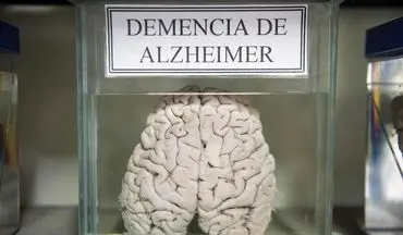 استقبال عجیب از موزه مغز های واقعی انسان در پرو/اسرار مغز را بخوانید 