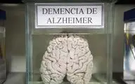 استقبال عجیب از موزه مغز های واقعی انسان در پرو/اسرار مغز را بخوانید 