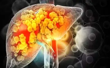 خطر چربی شکمی برای مغز: کوچک شدن و پیری زودرس