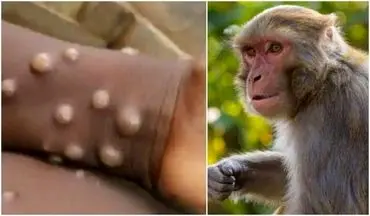 بررسی میزان اثرگذاری واکسن آبله بر "آبله میمونی"