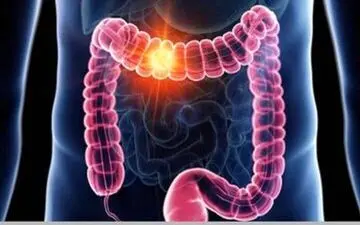 از کنار این علائم گوارشی به سادگی عبور نکنید