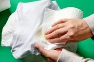 ابداع روش جدید پاک کردن لکه زرد سرسخت از روی لباس سفید