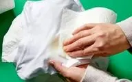 ابداع روش جدید پاک کردن لکه زرد سرسخت از روی لباس سفید