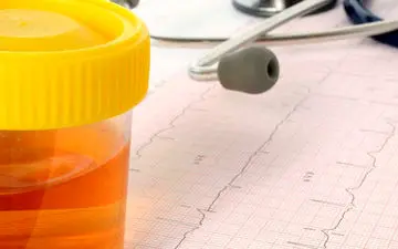 چگونه ادرار خونی را درمان کنیم؟