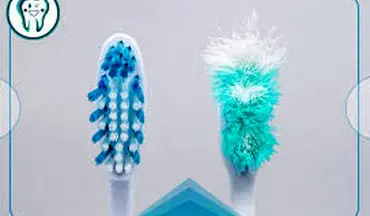 چه زمانی باید مسواک را عوض کرد؟
